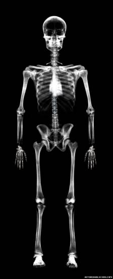 Incredible Human X-Ray Pictures - Photoshop / Graphics 626
