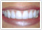 1st picture of Get a Perfect Smile with Kalyani Dental Hospitals, Hyderabad Offer in Cebu, Philippines