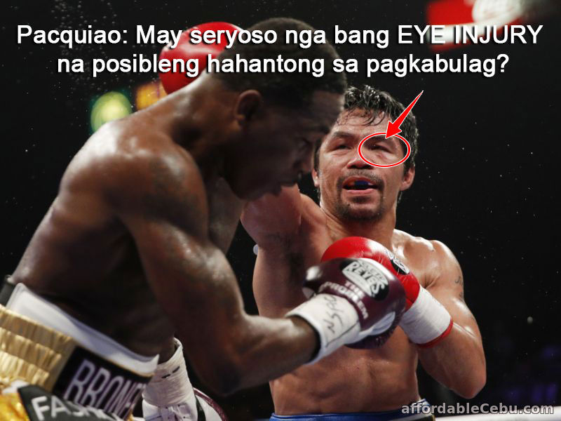Manny Pacquiao eye injury - vision loss